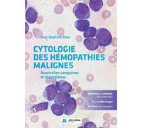 Cytologie des hémopathies malignes: Anomalies sanguines et médullaires