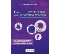 Cytologie des hémopathies malignes: Anomalies sanguines et médullaires
