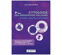 Cytologie Des Hémopathies Malignes - Anomalies Sanguines Et Médullaires