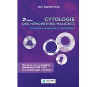 Cytologie des hémopathies malignes: Anomalies sanguines et médullaires