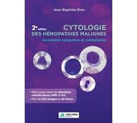 Cytologie des hémopathies malignes: Anomalies sanguines et médullaires