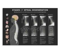 CZMDKEXM Scientific Spine Anatomy Poster Educational Body Chart Canvas Art Print Retro Diagram Wall Decor Home Study Doctor Office (8 X 12 in)