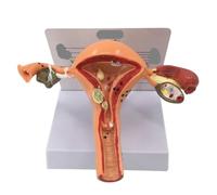 DANNMPX Modèle Humain Modèle D'ovaire De L'utérus Humain, Structure en Section Transversale, Anatomique, Organe Féminin Anatomique