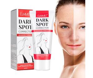 Dark Spot Corrector Remover, Crème Blanchissante, Creme Visage Anti Taches, Whitening Creme, Crème Anti-taches de Rousseur, Crème pour le Visage et le Corps, Nourrissante et Éclaircissant-60ml