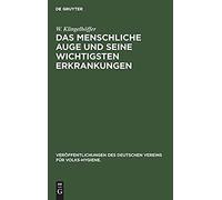 Das Menschliche Auge Und Seine Wichtigsten Erkrankungen