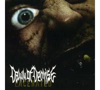 Dawn of Demise - Lacerated [Import]