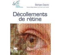 Décollements de rétine Georges Caputo (Auteur), Docteur Florence Metge Galatoire (Auteur), Carl Arndt (Auteur), John Conrath (Auteur), Société Française d'Ophtalmologie (SFO) (Auteur)