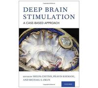 Deep Brain Stimulation