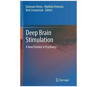 Deep Brain Stimulation