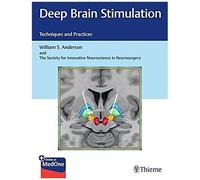 Deep Brain Stimulation