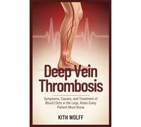 Deep Vein Thrombosis: Symptoms, Causes, and Treatment of Blood Clots in the Legs, Risks Every Patient Must Know