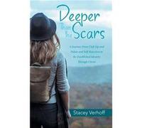 Deeper Than the Scars A Journey from Cleft Lip and Palate and SelfRejection to ReEstablished Identity Through Christ - Stacey Verhoff - Author Solutions I Stacey VerhoffStacey Verhoff (Auteur)