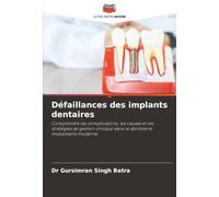 Défaillances des implants dentaires: Comprendre les complications, les causes et les stratégies de gestion clinique dans la dentisterie implantaire moderne