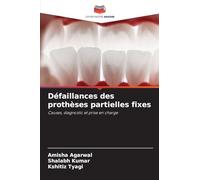 Défaillances des prothèses partielles fixes