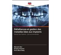Défaillances et gestion des maladies liées aux implants: Gestion des implants : Une vue d'ensemble