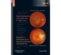 Dégénérescence maculaire liée à l'âge (DMLA) / Myopie et étiologies de la néovascularisation choroïdienne (volume 7 - coffret Rétine) Gabriel Quentel (Auteur), Éric Souied (Auteur), Salomon Yves Cohen
