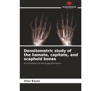Densitometric study of the hamate, capitate, and scaphoid bones: A contribution to bone age estimation