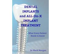 Dental Implants and ALL-on-X Implant Treatment: What Every Patient Needs to Know