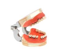 Dents dentaires Typodonts Modèle pour Parodontopathie Maladie Parodontale Amovible Gingivae Pathologie Modèle de Dents Utilisé dans l'enseignement, l'explication, l'étude pour adulte (Transparent)