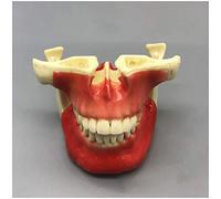 Dents Modèle maxillaires Implant Model - Pratique dentaire Modèle de Sinus Maxillaire - Étude des dents dentaires Modèle d'enseignement - Pratique Nail Anchorage Modèle, Sinus Maxillaire Lift,A