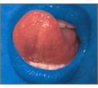 Depth Charge - Blue Lipps