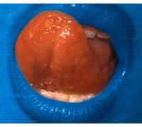 Depth Charge - Blue Lips [Import]