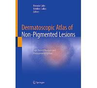 Dermatoscopic Atlas of Non-pigmented Lesions: Case-based Analysis and Management Options