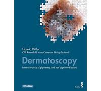 Dermatoscopy: Pattern analysis of pigmented and non-pigmented lesions