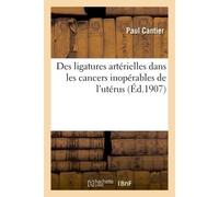 Des ligatures artérielles dans les cancers inopérables de l'utérus - Cantier - Hachette Bnf - broché - Livre