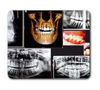 Destination Vinyl ltd Confortable Tapis de Souris - Dentiste 3D radiographie Dentaire 23,5 x 19,6 cm (9,3 x 7,7 Pouces) pour Ordinateur et Portable, Bureau, Cadeaux, Base antidérapante - RM21052