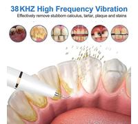 Détartreur Dentaire À Ultrasons Pour Le Tartre Dentaire, Les Taches Dentaires, Le Tartre Dentaire, Le Nettoyage Électrique De La Plaque Dentaire, L'élimination Du Tartre Dentaire