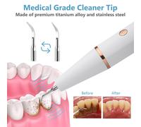 Détartreur Dentaire À Ultrasons Pour Les Dents Tartre Tache De Dents Calcul Dentaire Remover Électrique Sonic Dents Plaque Cleaner Dental Stone Removal F