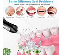 Détartreur Dentaire À Ultrasons Pour Les Dents Tartre Tache De Dents Calcul Dentaire Remover Électrique Sonic Dents Plaque Cleaner Dental Stone Removal K