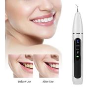 Détartreur Dentaire Électrique Ultrasonique Intelligent, Dissolvant De Plaque De Tartre, Nettoyeur De Taches, Outil De Blanchiment Des Dents Blanc