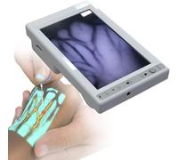 Détecteur de veines portable 1 pièce - Détecteur de veines infrarouge for une imagerie vasculaire précise chez l'adulte et l'enfant