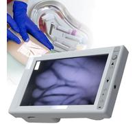 Détecteur de veines portable, écran LCD avec réglage de la luminosité infrarouge, for infirmières, médecins, personnes âgées et enfants