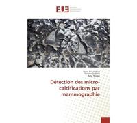 Détection des micro-calcifications par mammographie - Dorra Ben Sellem - Universitaires Europeennes - broché - Essai
