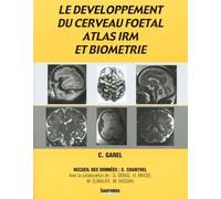 Le Developpement Du Cerveau Foetal, Atlas Irm Et Biometrie