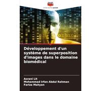 Développement d'un système de superposition d'images dans le domaine biomédical