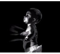 Diagnosis Murder: Shaken Baby Syndrome - Educational Version with Public Performance Rights