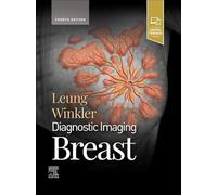 Diagnostic Imaging: Breast