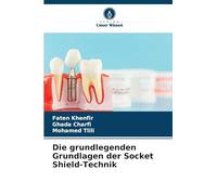 Die grundlegenden Grundlagen der Socket Shield-Technik