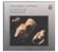 Die Nacht aus Blei - Sappho-gesänge