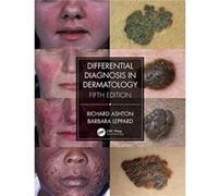 Differential Diagnosis in Dermatology - Barbara Leppard - Taylor amp Francis Ltd - Livre en Anglais - Paperback Barbara LeppardBarbara Leppard (Auteur)