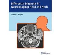 Differential Diagnosis In Neuroimaging: Head And Neck Unknown (Auteur)