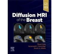 Diffusion MRI of the Breast Diffusion MRI of the Breast (Auteur)