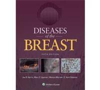 Diseases Of The Breast (Hardcover) Harris, (Auteur)