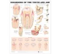 Disorders of the Teeth and Jaw Anatomical Chart