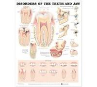 Disorders of the Teeth and Jaw Anatomical Chart