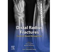 Fractures du radius distal – Prise en charge fondée sur les preuves